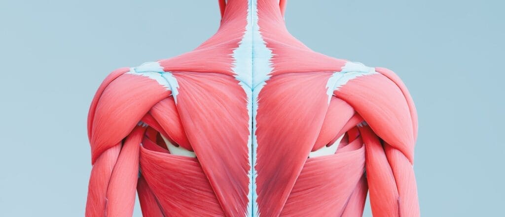 "Image showing the anatomy of back muscles, highlighting areas where lactic acid buildup can occur during exercise."